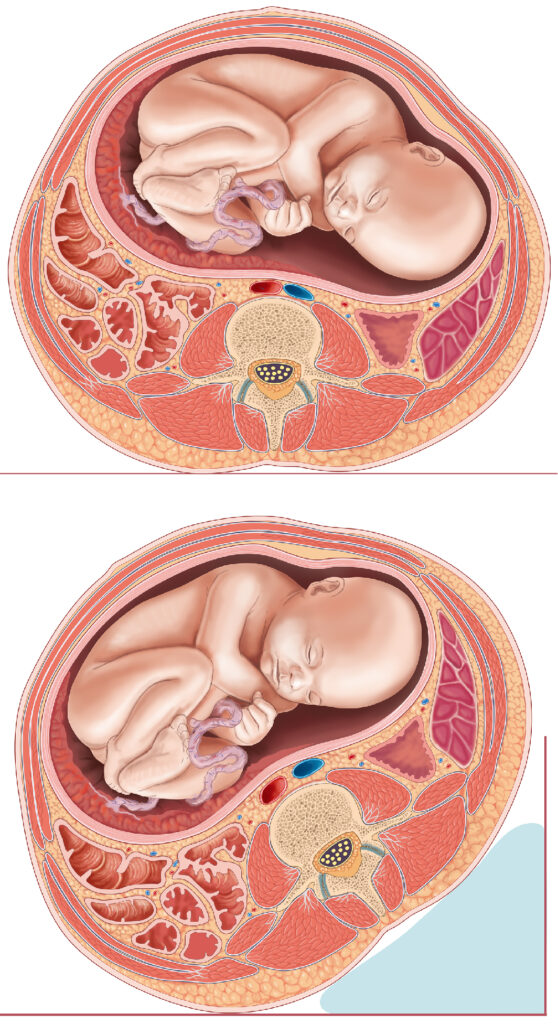 fœtus anatomie coupe foetus 