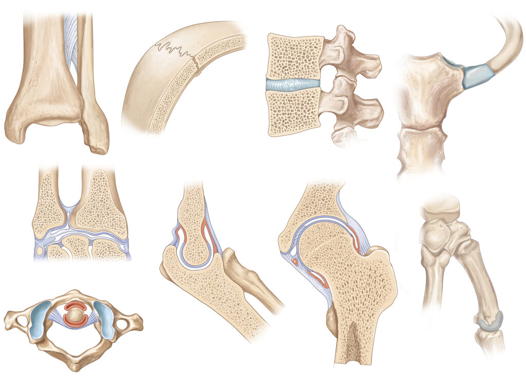 articulations os 