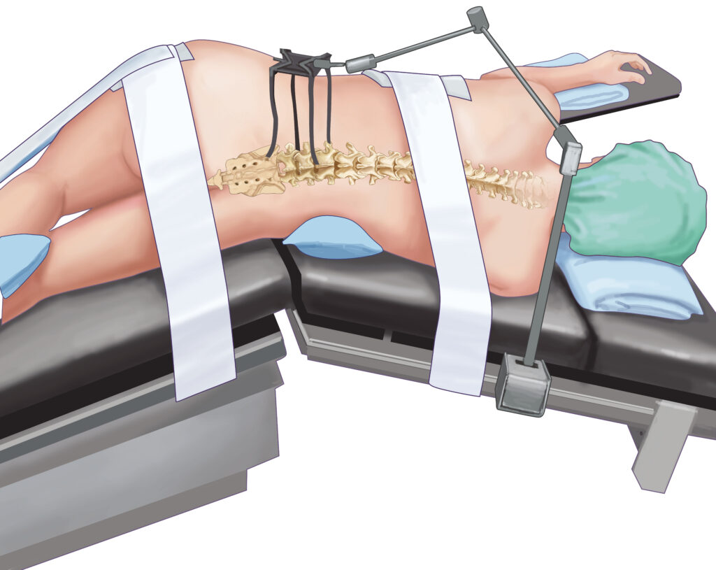 voie abord position patient